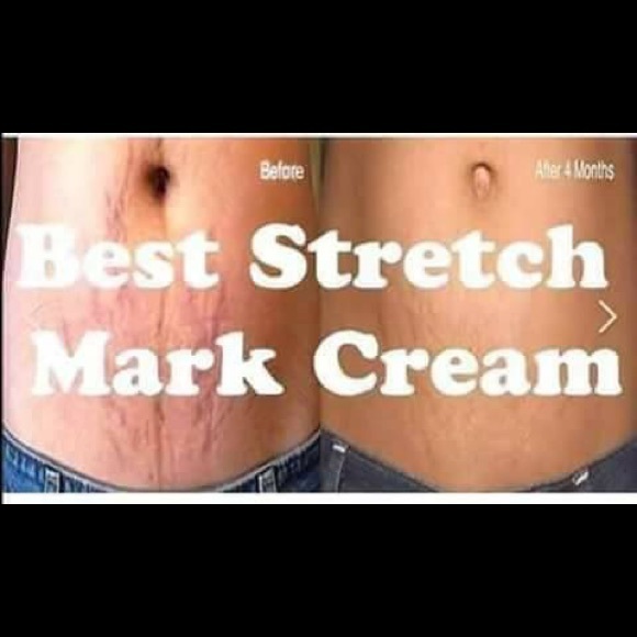 Scarless Cream Acne Stretch Mark Pimple Marks - Picture 5 of 8